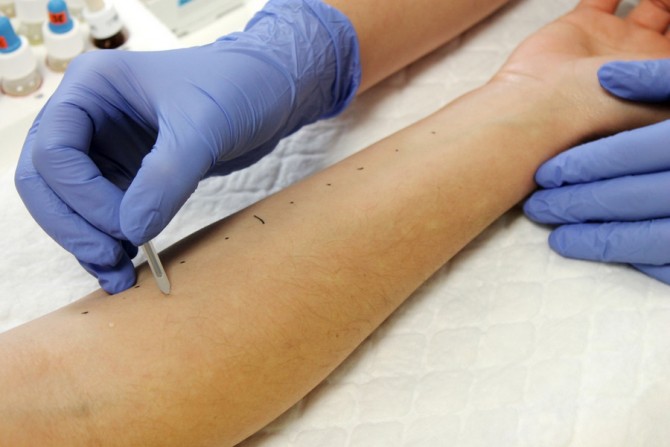 4. Enfermidades profesionais no sector agropecuario: Doenzas dermatolóxicas